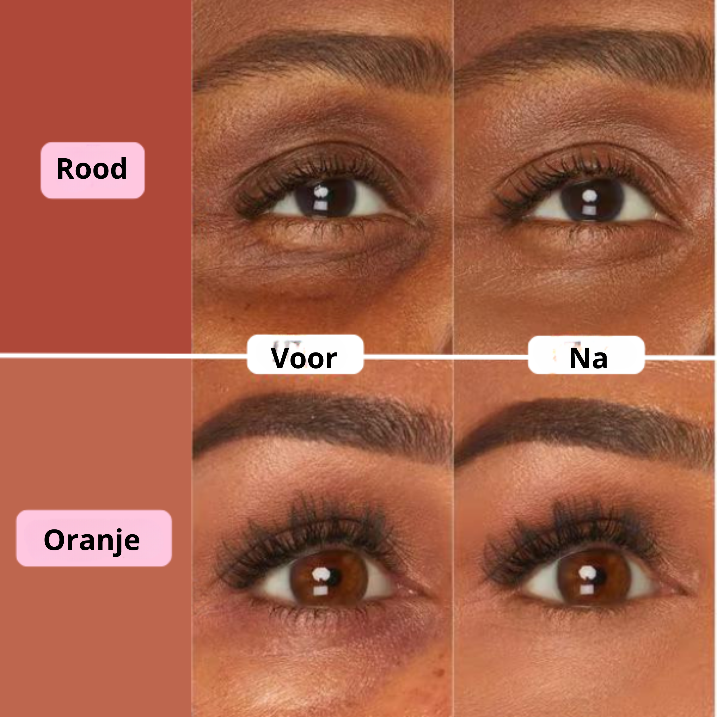 Zola™ | Concealer voor onder de ogen